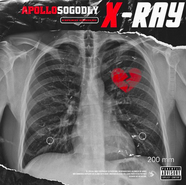 Stream APOLLOSOGODLY X-Ray
